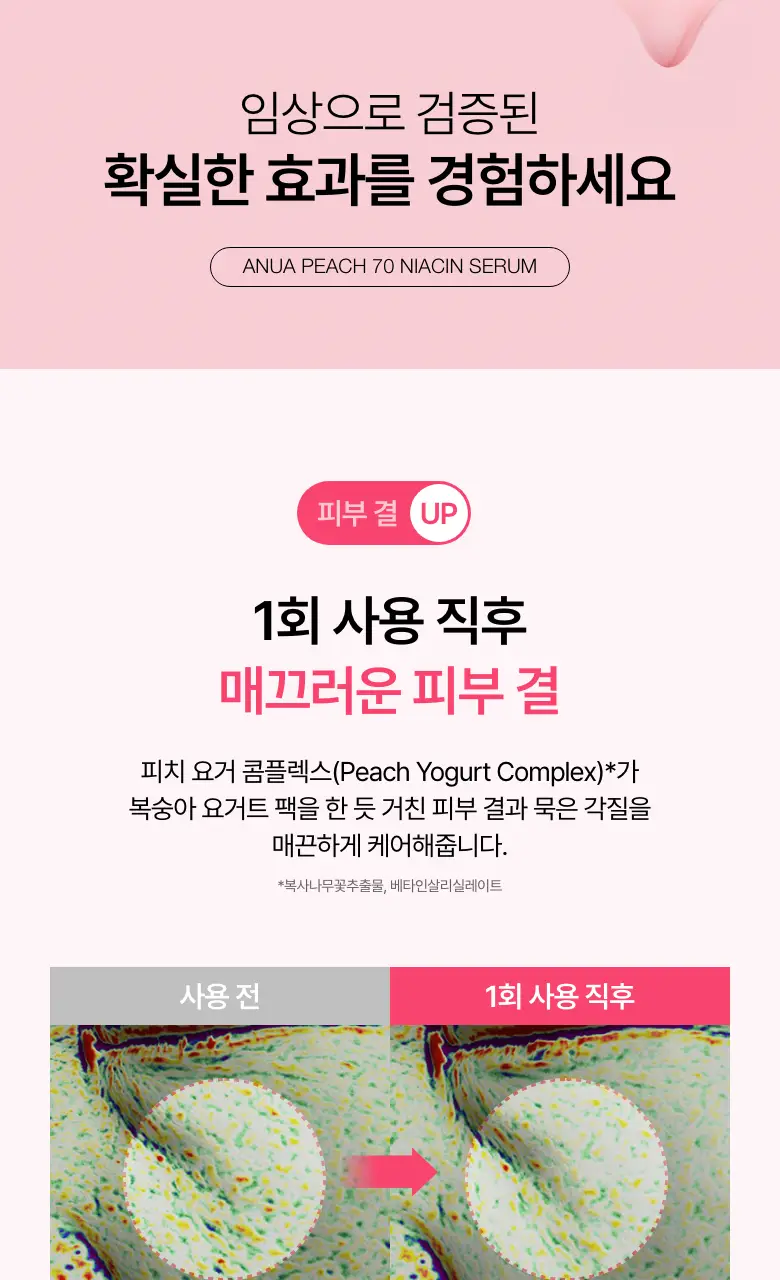 [단독기획] 아누아 복숭아 70 나이아신아마이드 세럼 30ml 2입 상세페이지 12